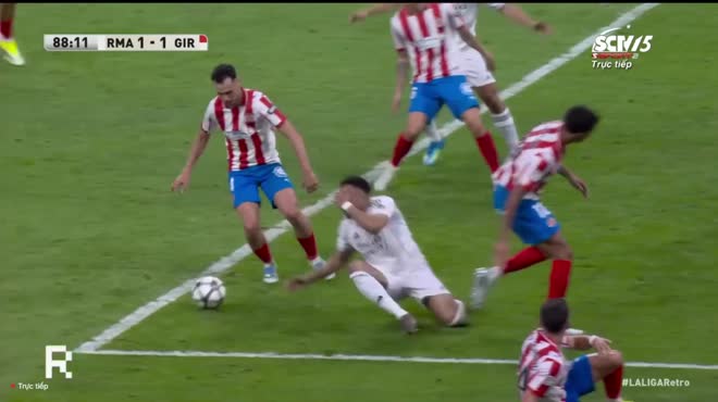 Mbappe đổ máu, Real Madrid bức xúc vì mất phạt đền - Ảnh 1
